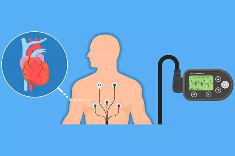 Holter EKG
